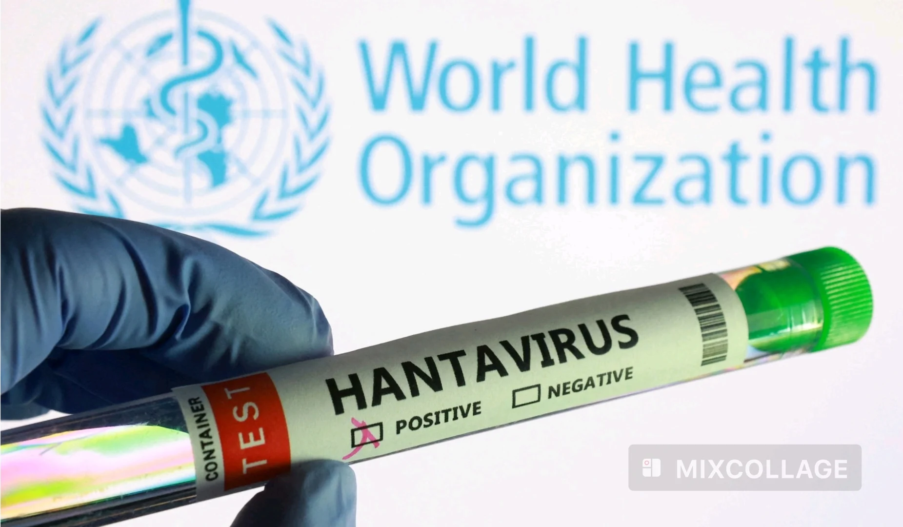 Harare Says No Confirmed Hantavirus Cases as Health Monitoring Continues